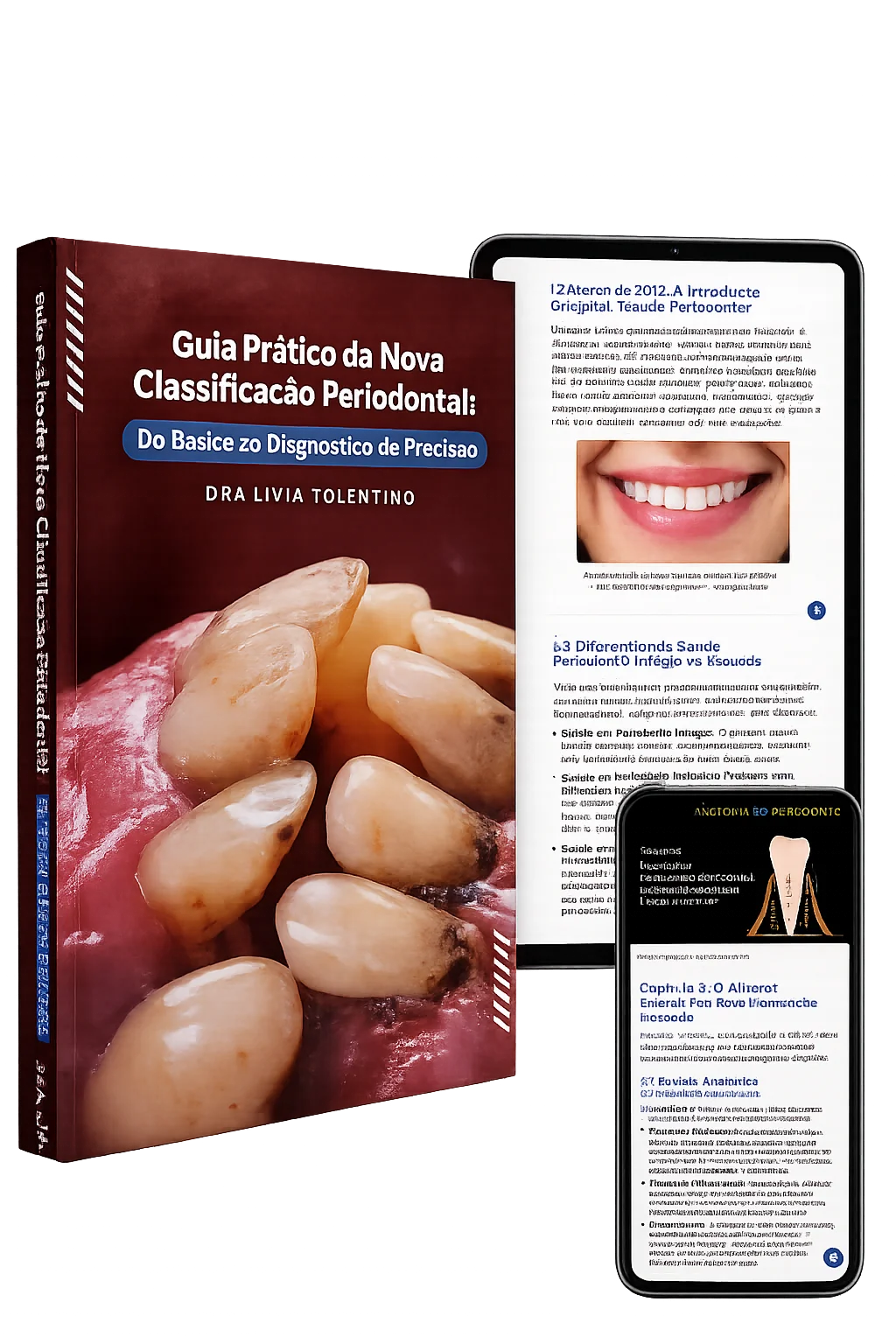 Mockup do ebook 'Guia Prático da Nova Classificação Periodontal' com o checklist do periodograma perfeito